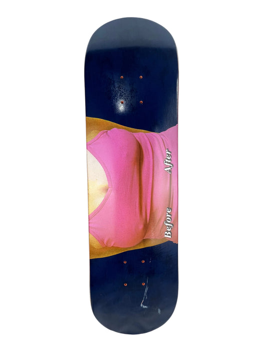 Skate Mental Before & After Pink Blue Size 8.25" Vintage NOS Deck